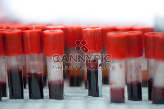 Tubes of blood in rack closeup - image gratuit #347257 